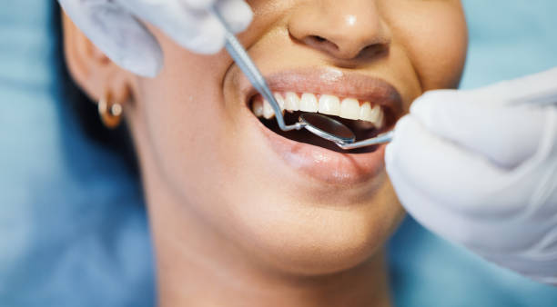 Best Emergency Dental Services for Seniors in Hyde Park, UT